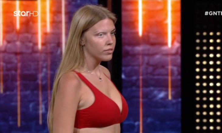 GNTM: Η παίκτρια με την λεύκη που "σόκαρε" τους κριτές GNTM: Η παίκτρια με την λεύκη που "σόκαρε" τους κριτές