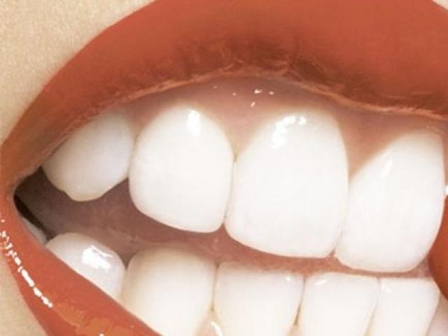 Λευκά δόντια με φυσικό τρόπο! 